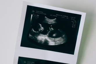 Dra. Thaline Neves explica como o diagnóstico de malformações fetais permite identificar alterações no desenvolvimento de forma precoce e segura.