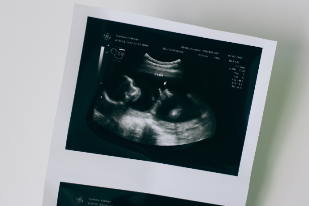 Dra. Thaline Neves explica como o diagnóstico de malformações fetais permite identificar alterações no desenvolvimento de forma precoce e segura.