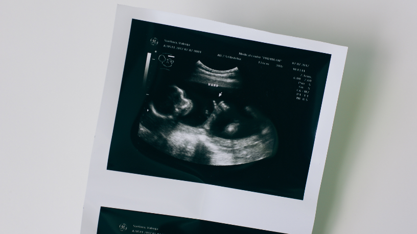 Dra. Thaline Neves explica como o diagnóstico de malformações fetais permite identificar alterações no desenvolvimento de forma precoce e segura.